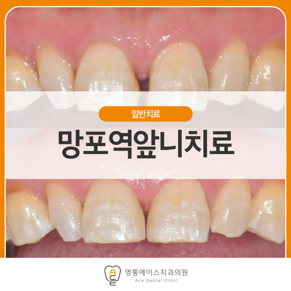 망포동치과