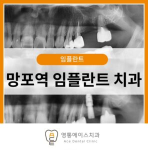 망포역임플란트치과