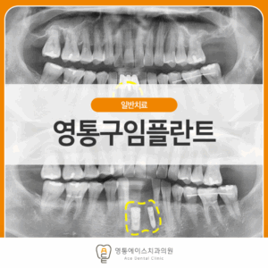 망포역임플란트