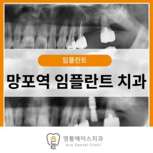 망포역임플란트치과