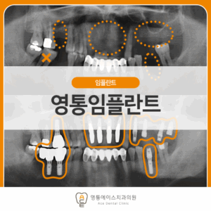 망포역임플란트