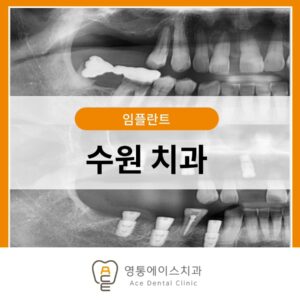 수원 치과