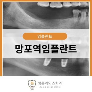 망포역치과
