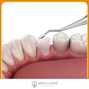 망포역임플란트치과