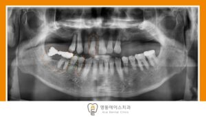 수원 치과