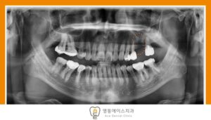 망포역임플란트치과