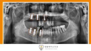 수원 치과