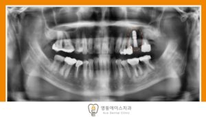 망포역임플란트치과
