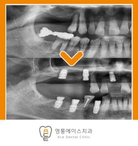 수원 치과
