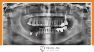 망포역치과