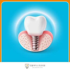 망포역임플란트치과