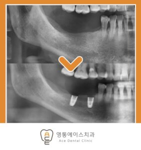 망포역치과
