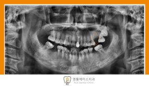 영통동치과