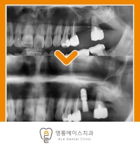 망포역임플란트치과