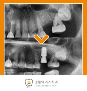영통동치과
