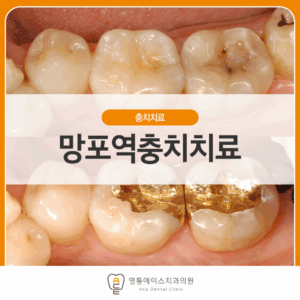 망포역치과