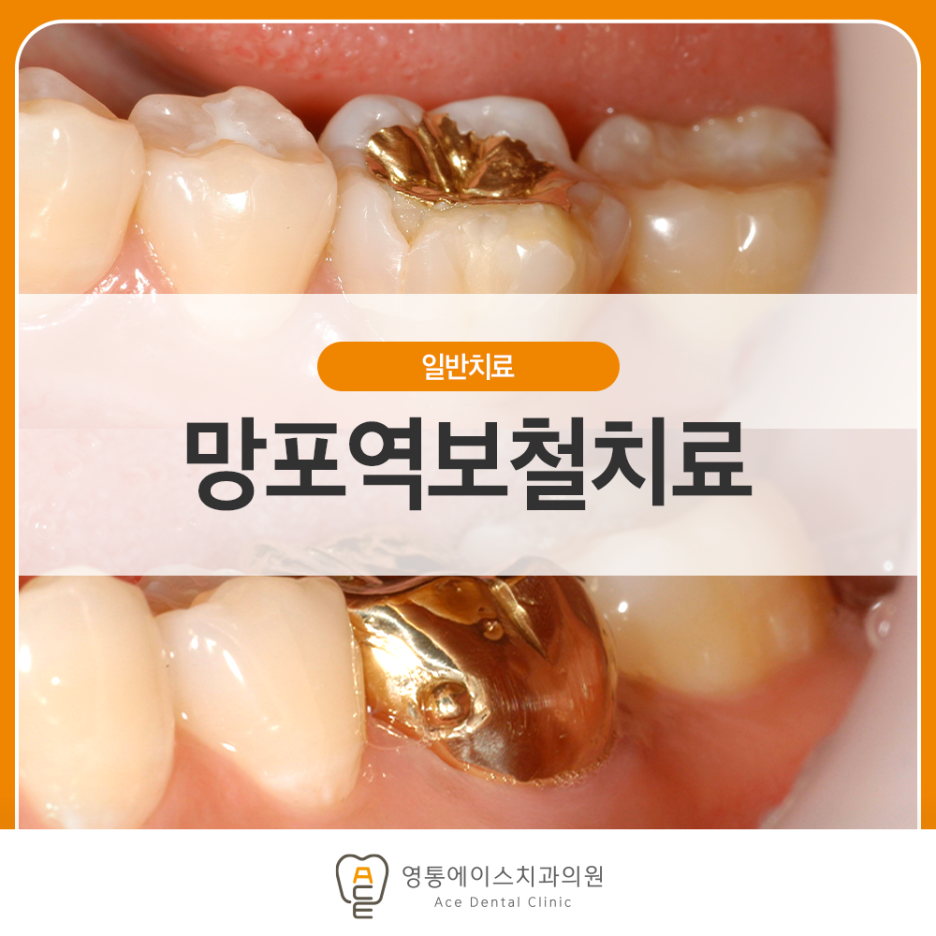 영통치과