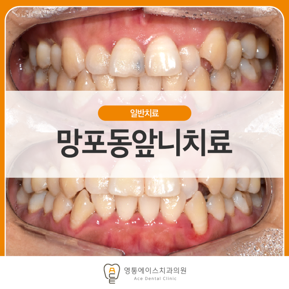 망포동치과