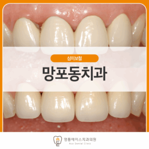 영통에이스치과 심미보철