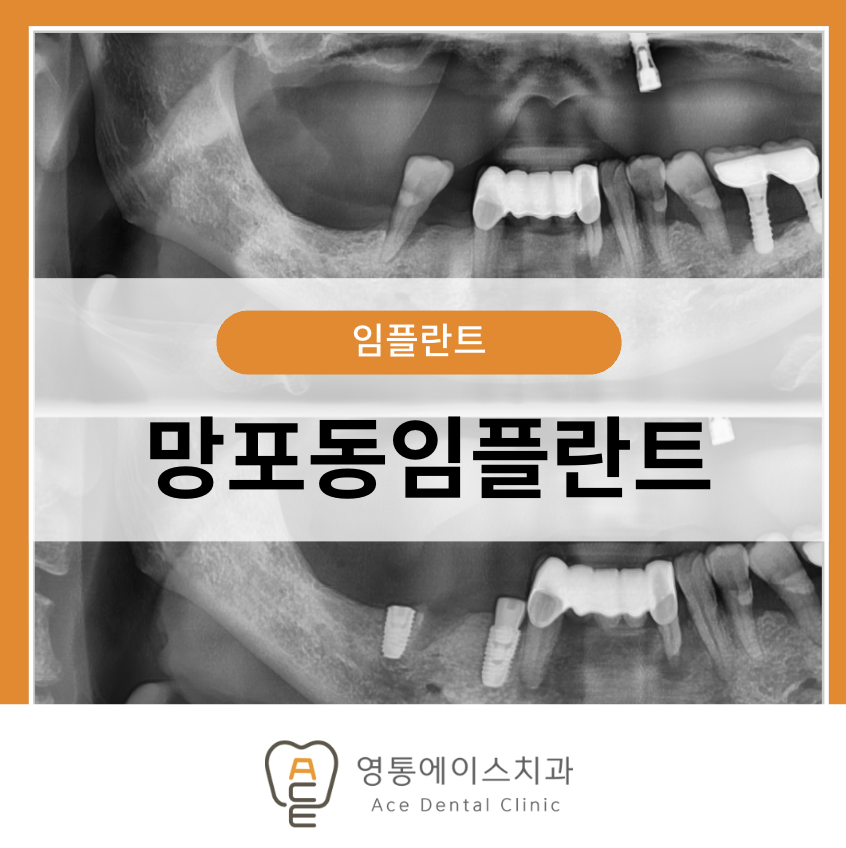 망포역임플란트