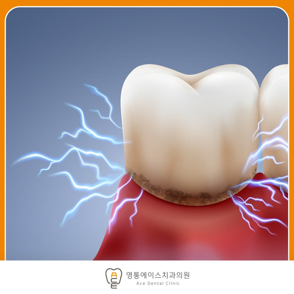 망포동임플란트