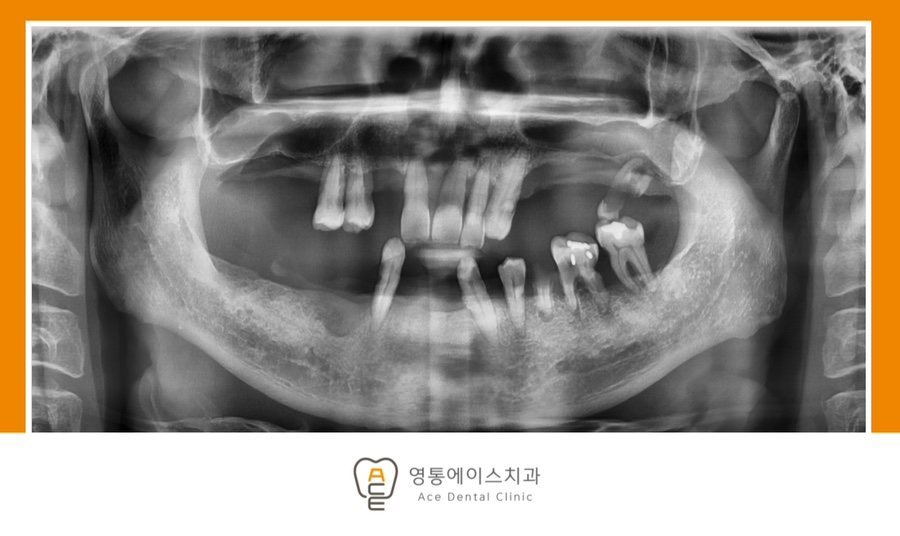망포역임플란트