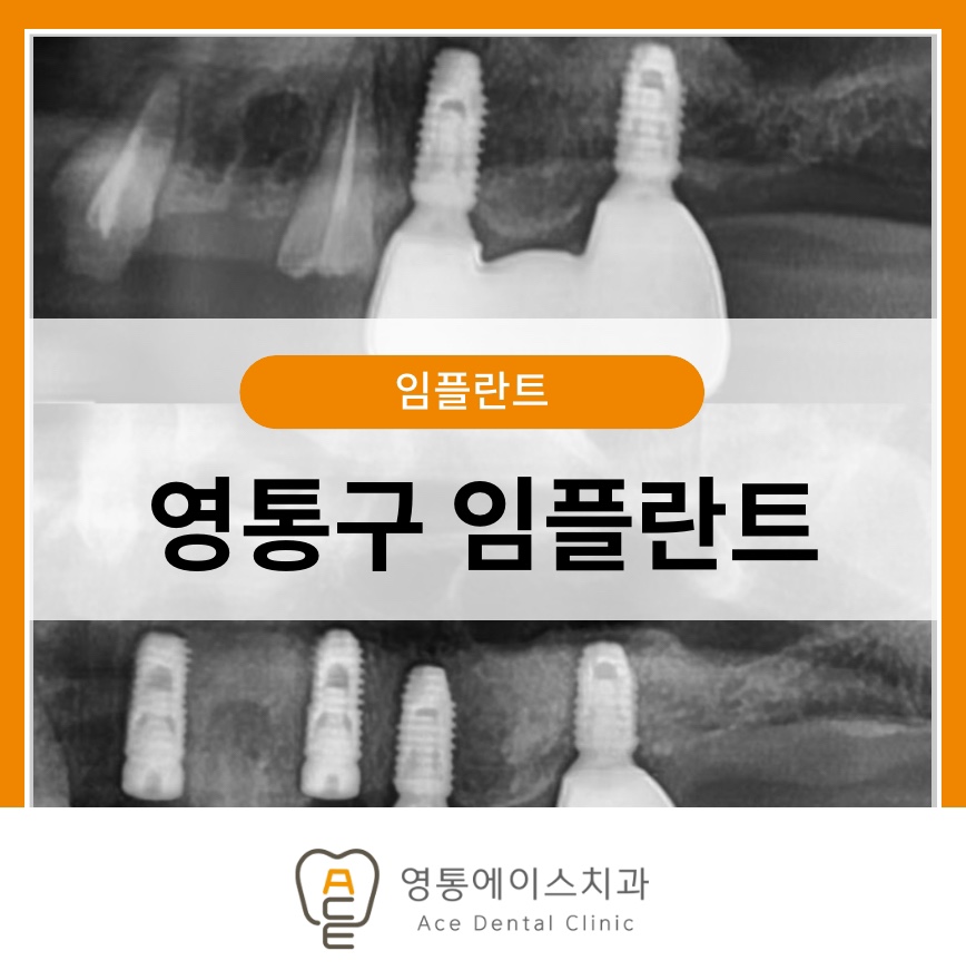 망포동치과