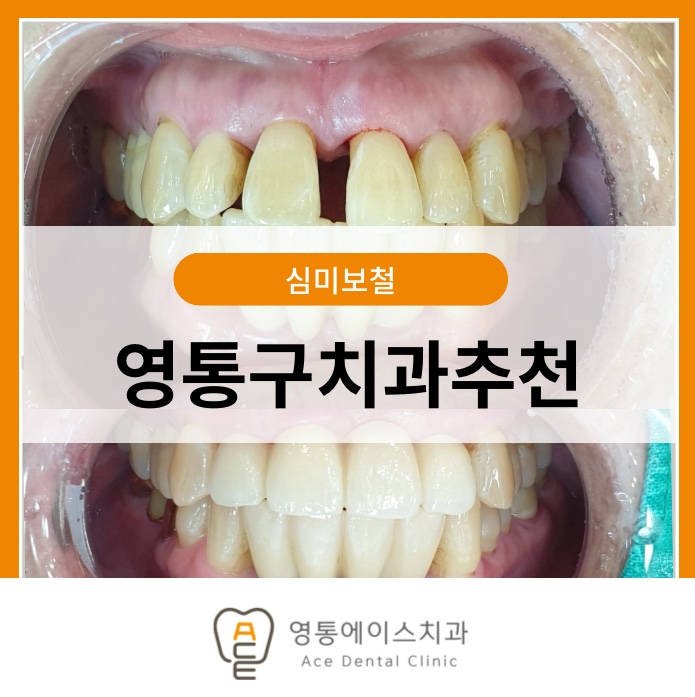 망포역치과