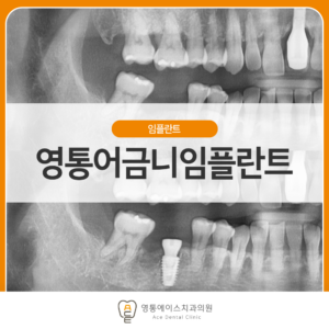 망포역치과