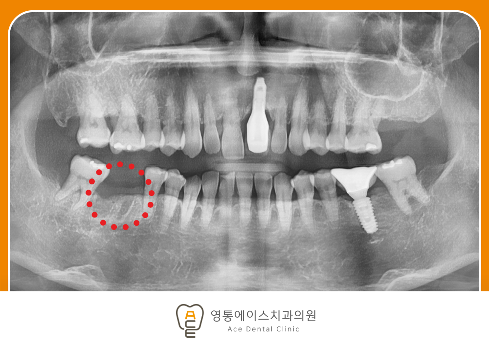 망포역치과