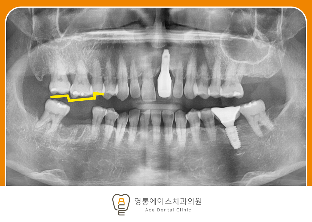 망포역치과