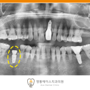 망포역치과