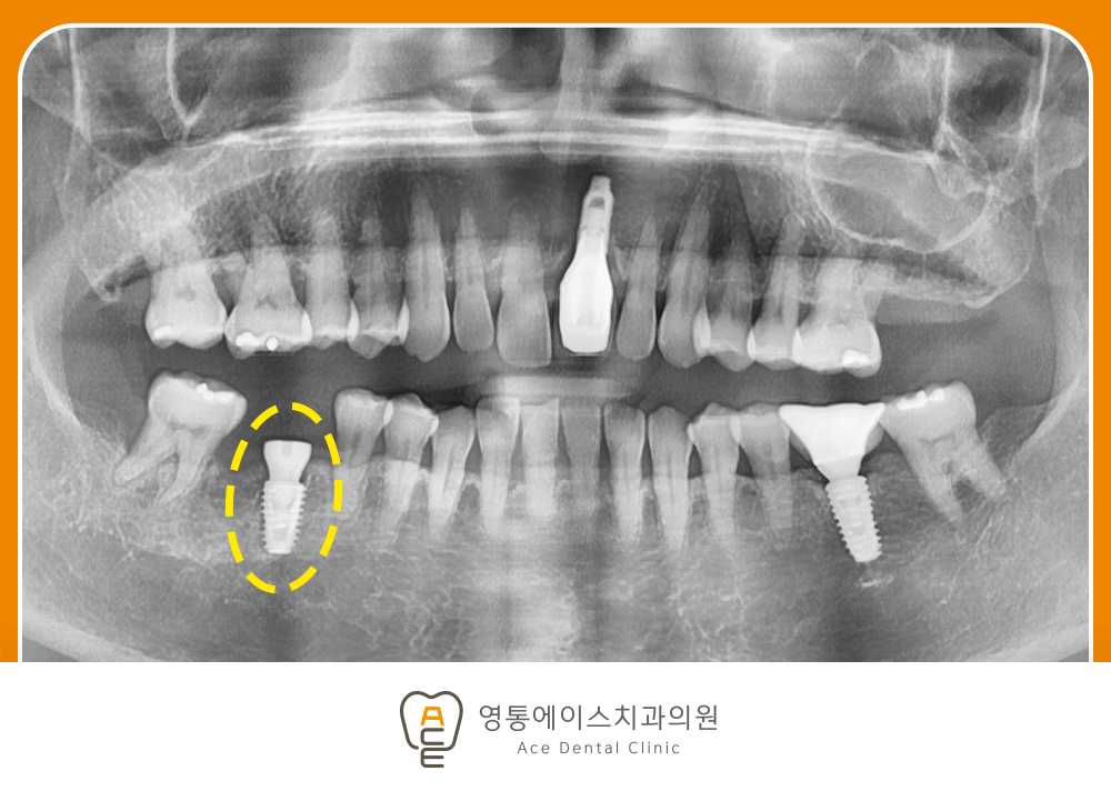 망포역치과
