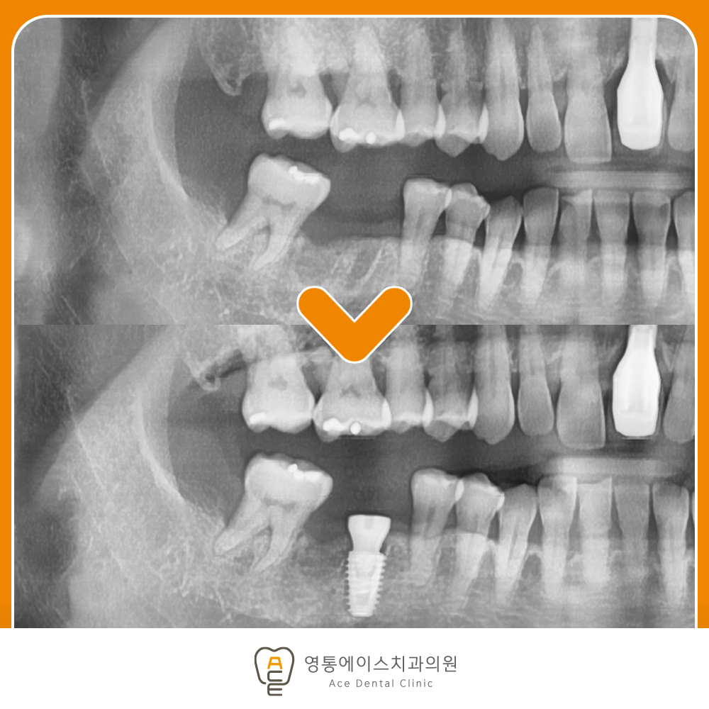 망포역치과