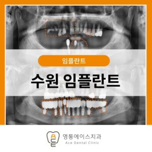 망포역보험임플란트
