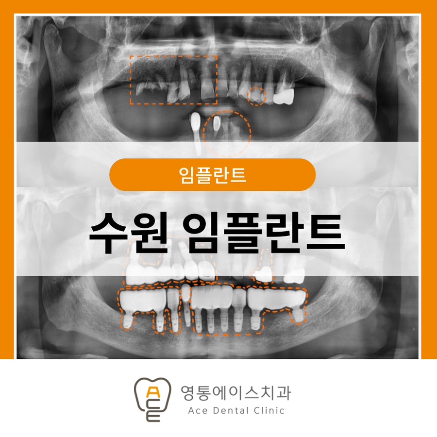 망포역보험임플란트