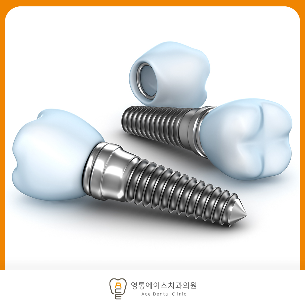 망포역임플란트