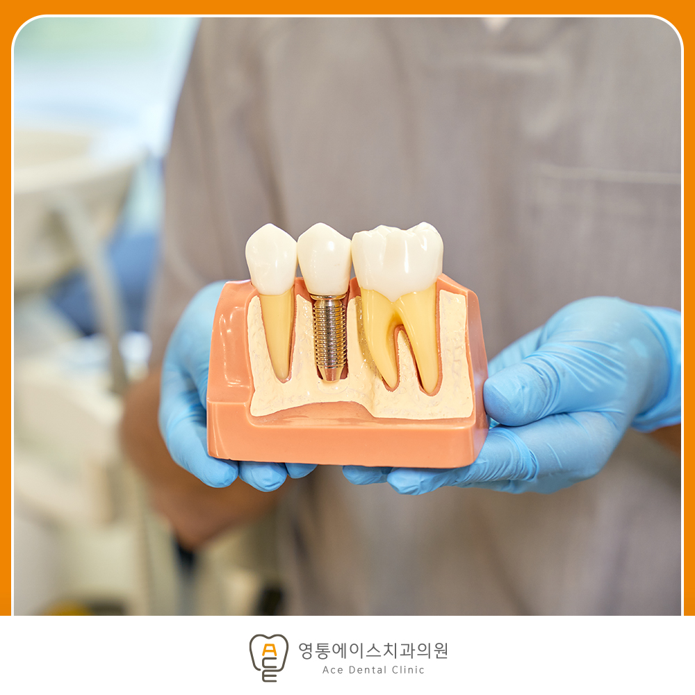 망포역임플란트