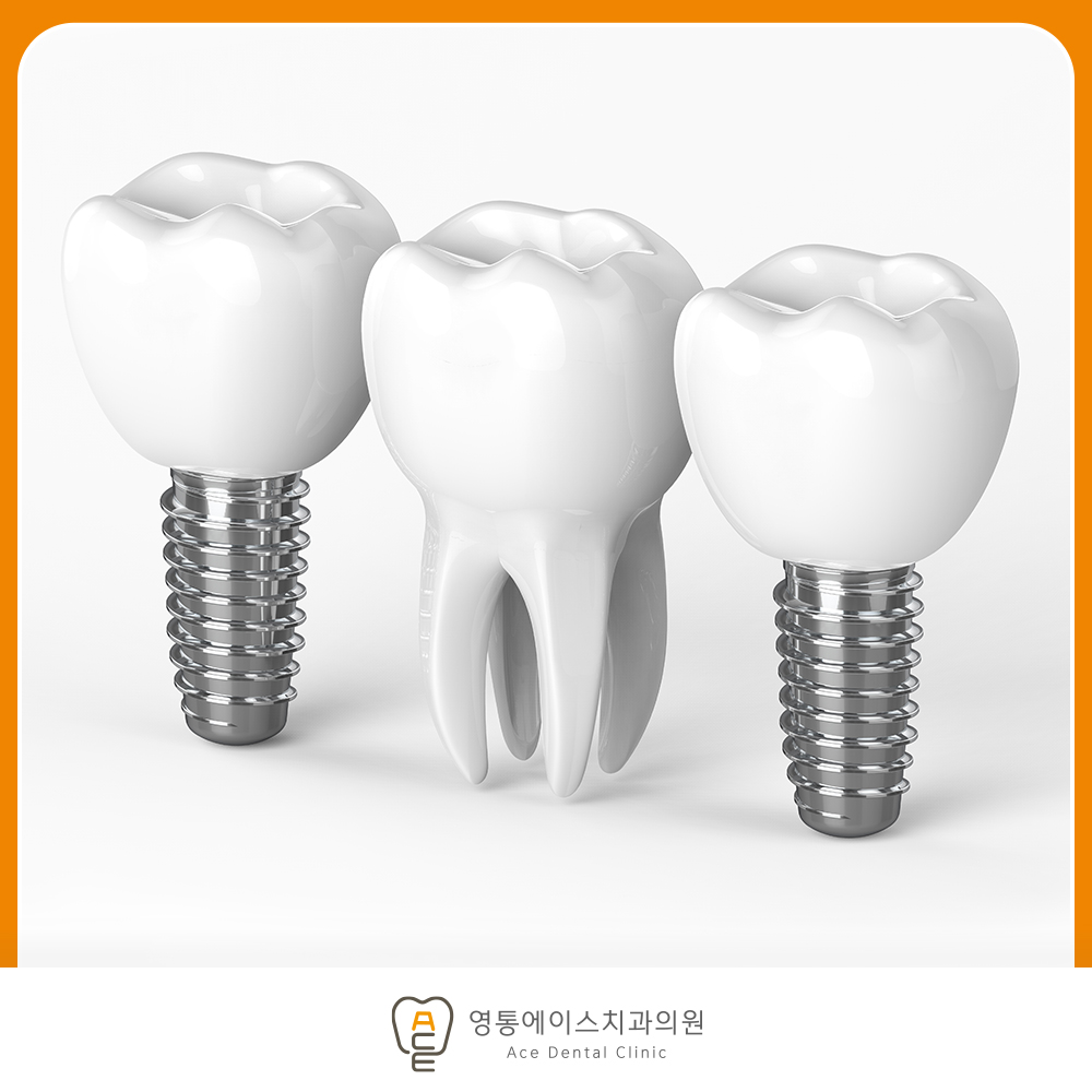 망포역임플란트