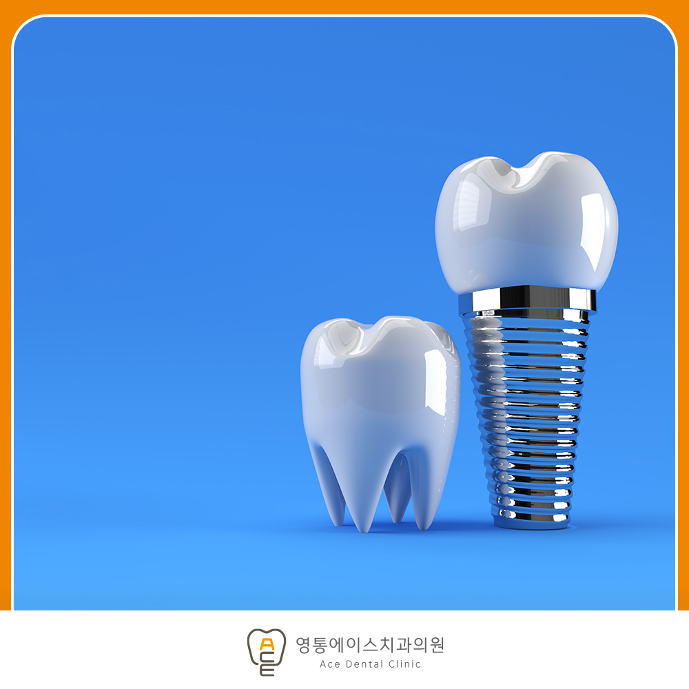 망포역임플란트
