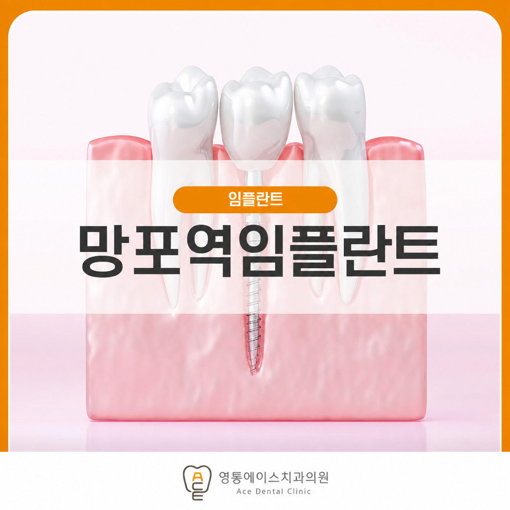 치주 질환 증가로 자연 치아를 잃은 젊은 환자